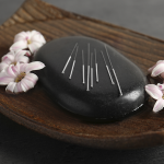 Acupuntura – O que é e como funciona a acupuntura – Pelo Consultor Eloi