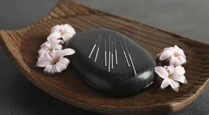 Acupuntura – O que é e como funciona a acupuntura – Pelo Consultor Eloi